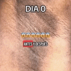 TRULY BEAUTY | Aceite para el Cuidado de la Zona Íntima Externa